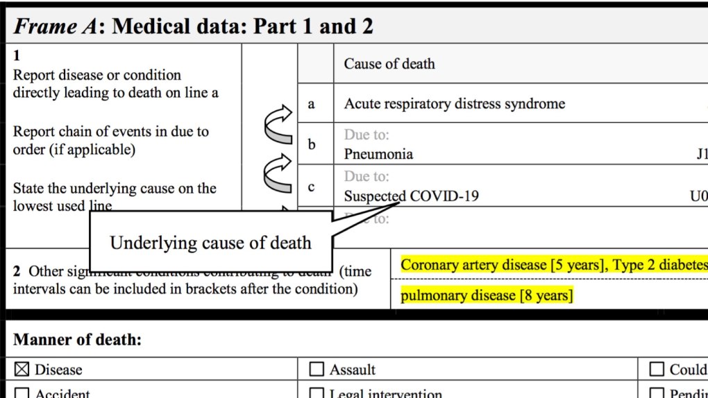 Formulaire international de certificat médical de cause de décès - Suspicion de COVID-19